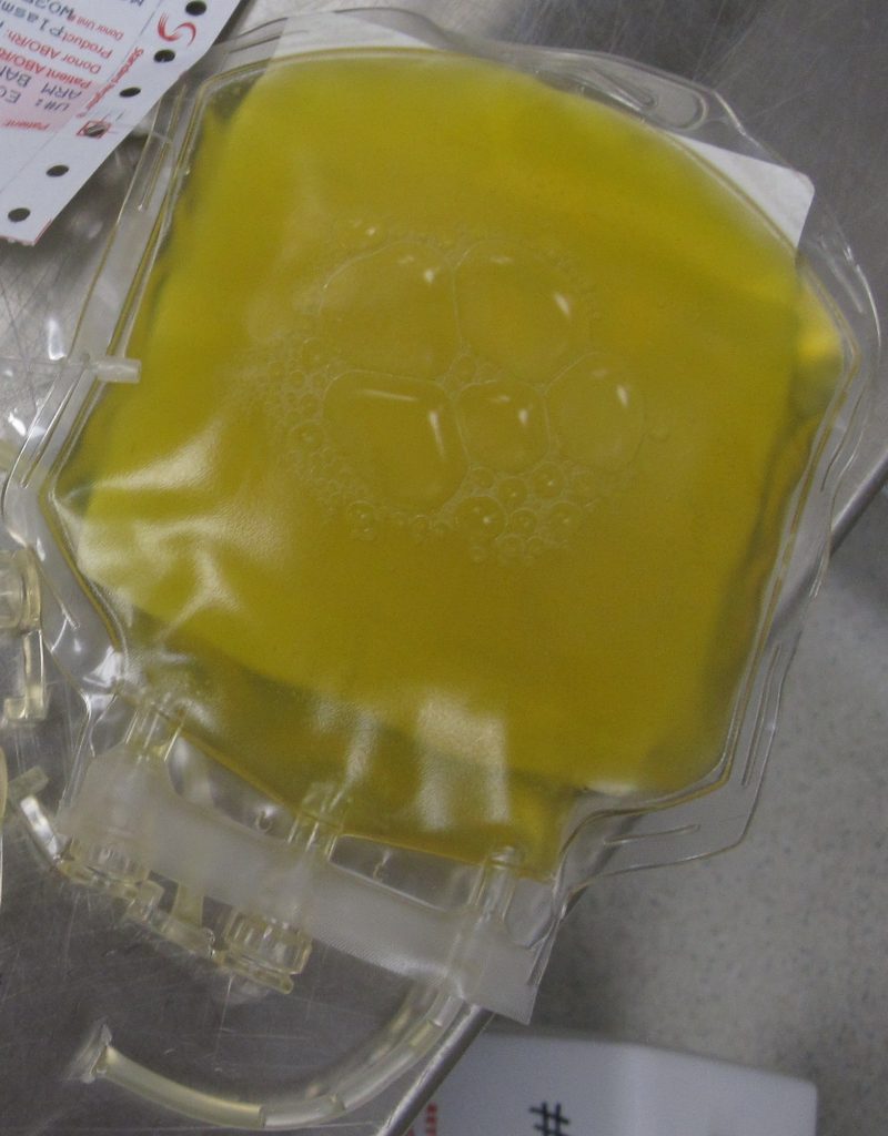 A bag containing one unit of fresh frozen plasma. | "FreshFrozenPlasma" by DiverDave, WikiMedia Commons is licensed under CC BY-SA 3.0