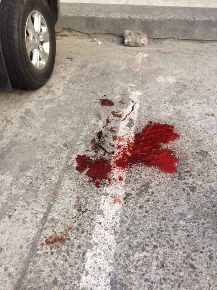 A splatter of blood from where the victim stood when he was shot. | Photo by Banjo Hinolan